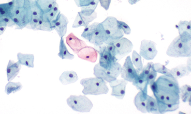 Cytology